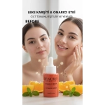 Belmoren C Vitamini Serum - Görsel 3
